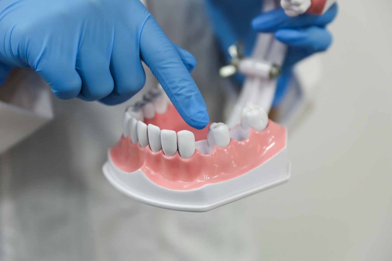 Dental Implant Procedure FAQs